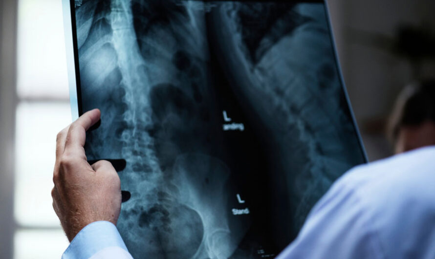Более 50 единиц нового рентген-оборудования появится в больницах Новосибирской области